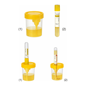 Contenedor de Muestras de Orina de PP Estéril y Juego de Tubos de Vacío de PET para Recolección y Transporte - Product Image 3