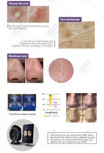 Solución de Suero Líquido, Consejos para la Máquina Facial Hydra Beauty - Product Image 3