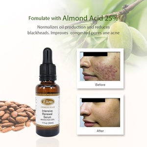 Almond Acid 25% Niacinamide Herbal Anti-Aging Whitening Gel <b>Serum</b> for <b>Face</b> Skin Brightening & Peeling All Non-Sensitive Skin - Product Image 2