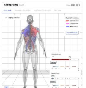 เครื่องวิเคราะห์ร่างกายอัจฉริยะ Bodydot BDF1000 ใช้พลังงาน AI โครงอะลูมิเนียมอัลลอยด์ ไม่สามารถพับได้ ติดตามท่าทางร่างกายแบบเต็มรูปแบบ เพื่อสุขภาพที่ดีขึ้น - Product Image 3