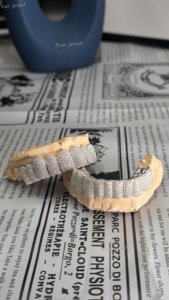 Juego de Grillz Personalizados de Moissanita VVS, Plata de Ley 925, Totalmente Cubiertos de Piedras, para Dientes Inferiores, Joyería Dental para Hombres - Product Image 4