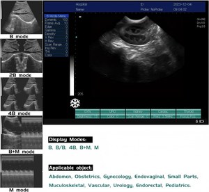 Mesin <span class=keywords><strong>Ultrasound</strong></span> portabel kualitas tinggi mesin dasar Laptop BW pemindai <span class=keywords><strong>Ultrasound</strong></span> peralatan rumah sakit mesin <span class=keywords><strong>Ultrasound</strong></span> untuk manusia - Product Image 5