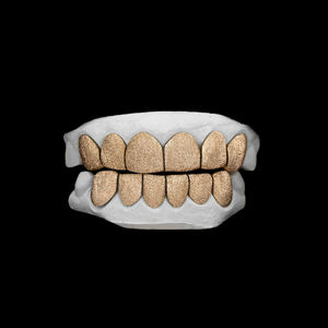 Grillz Hip Hop sur mesure en argent sterling 925 plaqué or, serti de moissanite, pour dents - Product Image 4