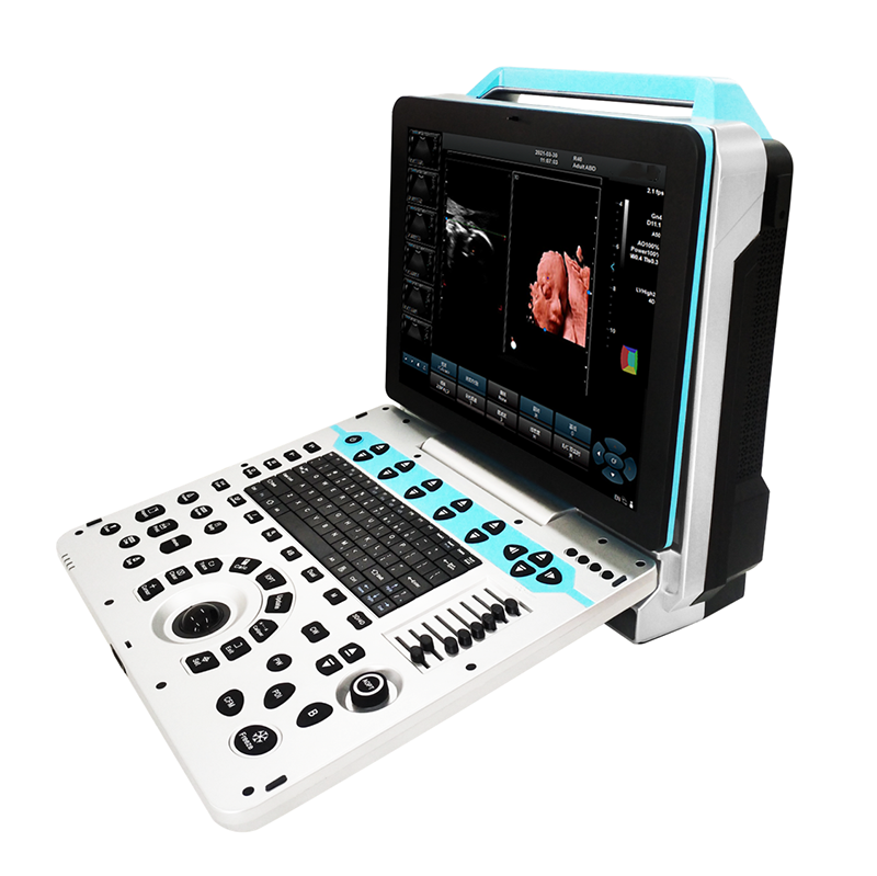 MN-Ultra5 جهاز أولتراسونيك طبي محمول بتقنية دوبلر ثلاثي الأبعاد وملون من علامة تجارية شهيرة