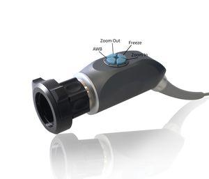 TU-24LSD1B टेलीपैक पोर्टेबल कैमरा एंडोस्कोपिक यूरोलॉजी के लिए सर्जिकल उपकरण साइटोस्कोप नेफ्रोस्कोप यूरोलॉजी सर्जिकल उपकरण - Product Image 2