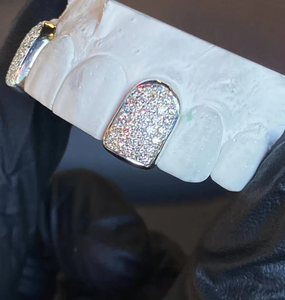 Grillz Diamantés de Luxe pour Dents, Sur Mesure, Bijoux Hip-Hop Tendance pour Hommes et Femmes - Product Image 2