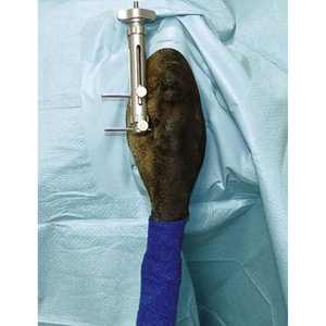 PISSCO Veterinary Stifle Distractor Dog Stifle Distractor Arthroscopic Evaluation <b>Instrument</b> Lateral Meniscus Evaluation Tool - Product Image 4