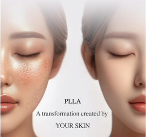 Premium Spherical PLLA Skin Rejuvenation Solution for Wrinkle Care and <b>Face</b> Lifting High Density Collagen Boosting Formula Vial - Product Image 3