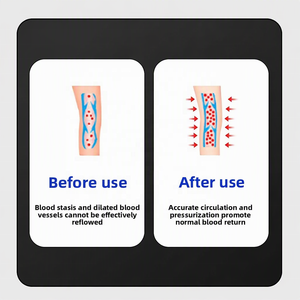 Masseur pour les pieds et les jambes, pression d'air réglable, contrôle de la durée, récupération douce pour le confort des jambes, AS ALL STAR CE - Product Image 4