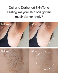 Corrector de Manchas Oscuras Blue Petal con Ácido Tranexámico y Niacinamida 30ml, Suero Reparador y Aclarante para Mujeres Adultas - Product Image 2