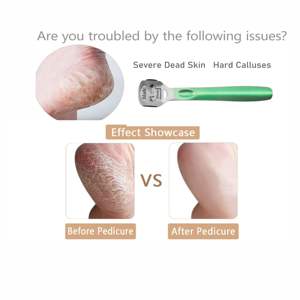 Lima profesional de acero inoxidable para pies, empujador de cutículas, eliminador de callos, herramienta rasuradora con 10 cuchillas de filo afilado y mango de plástico. - Product Image 3