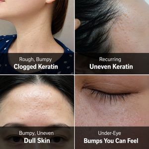 ดร.ดีพ เท็กซ์เจอร์ เทิร์นโอเวอร์ ครีม เอเอชเอ พีเอชเอ แอลเอชเอ สปอต แคร์ บำรุงผิวกระจ่างใส เรียบเนียน ปรับสีผิวให้สม่ำเสมอ พร้อมมอบความชุ่มชื้น ครีมบำรุงผิวหน้า - Product Image 3