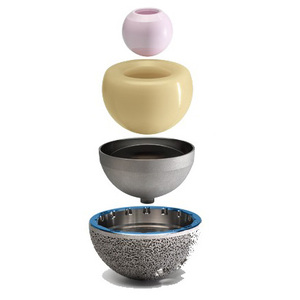 ZIMMER VIVACIT-E Vitamine E, polyéthylène hautement réticulé, composant d'implant médical de qualité supérieure pour la chirurgie orthopédique - Product Image 2