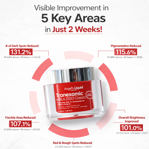 ครีมทรานเน็กซามิกแอซิดของแองเจิล ช่วยปรับผิวกระจ่างใส ลดเลือนจุดด่างดำ ฝ้า กระ จุดด่างดำจากฮอร์โมน ปรับสีผิวให้สม่ำเสมอ ด้วยไนอะซินาไมด์ สำหรับผิวหน้า - Product Image 1