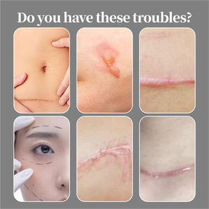 Solution Réparatrice Cutanée pour Cicatrices : Liquide de Soin pour la Plupart des Types de Cicatrices – En Stock - Product Image 5