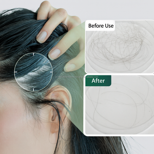 Fiala avanzata del cuoio capelluto della biotina acida delicata di bellezza K con mentolo e salicilico per la cura quotidiana dei capelli coreano oem - Product Image 4