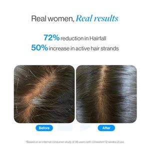 บี-บอดี้ไวส์ เซรั่มบำรุงเส้นผมสูตรโรสแมรี่ 3% (แบบโรลออน) ผสมเรเดนซิล 3% และแอนไกน์ 2% |   ผมหนาขึ้นและแข็งแรงขึ้น |   0.34 ออนซ์ (10 มล.) - Product Image 3