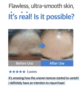 Crema Facial Hyper Mineral para Renovación de la Piel con AHA, PHA y LHA, Exfoliación Suave, Cuidado para Textura Áspera, Solución Facial Iluminadora - Product Image 3