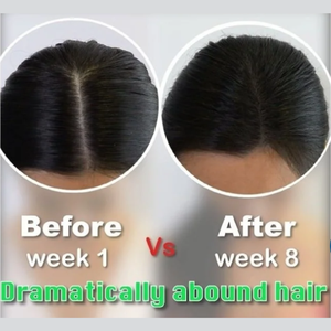 SMIB InnaBi Biotin Coral Calcium Copper Peptide Shampoo Hair Loss Care Protein Repair Scalp Cleansing Oil Control Hydrating - Product Image 3