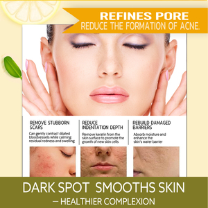 Crème Visage Éclaircissante Mestin Private Label Vitamine C Acide Hyaluronique Hydratation Récupération Après-<span class=keywords><strong>Soleil</strong></span> Nuit Anti-Âge Éclat 50ml - Product Image 5
