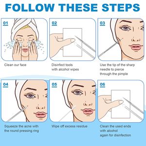 11cm High Carbon Steel Face Comedone <b>Extractor</b> <b>Tool</b> | Professional Double-Ended Acne & <b>Blackhead</b> Remover - Product Image 4