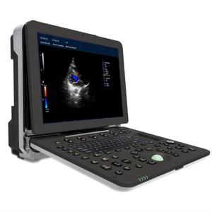 DW-P8 दावेई अल्ट्रासाउंड मशीन/सोनोग्राफी मशीन पोर्टेबल अल्ट्रासाउंड कलर डॉपलर - Product Image 6