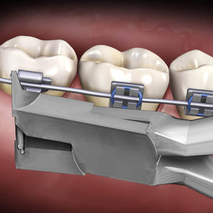 Cisaille orthodontique à coupe fine et à maintien de la pointe distale, à long manche, instrument dentaire de précision en acier inoxydable - Product Image 1
