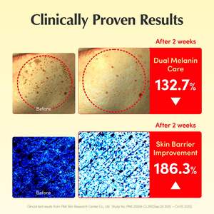 Crema Iluminadora con Vitaminas EQQUALBERRY, Vitamina C y 5% de Niacinamida + 3% de TXA, Humectante y Antienvejecimiento, Blanqueadora - Product Image 5