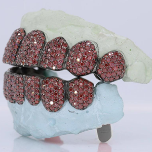 Grillz dentaire en argent 925 plaqué or, style diamant taillé en profondeur, clarté VVS, avec moissanite, brillance moderne et haute réflexion, Inde - Product Image 3