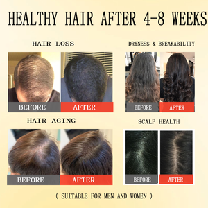 120g Batana minyak Pria & Wanita 100% Batana mentah & organik minyak meningkatkan ketebalan rambut minyak rambut organik untuk pertumbuhan rambut - Product Image 4