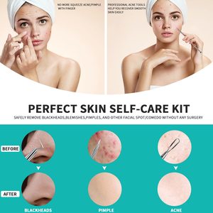Blackhead Removal Tool Kit Pimple Popper Tool Professional High Quality Stainless Steel Pimple <b>Extractor</b> Blackhead And Whitehead - Product Image 2