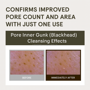 Detergente Delicato in Gel OEM K Beauty con LHA, Acido Ialuronico e Madeca, Stile Essenza Idratante per Pelle Luminosa e Effetto Vetro Coreano - Product Image 5