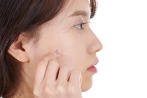 Fabriqué en Corée, patch anti-imperfections fin et discret |   Nouvelle technologie EZ Touch |   Traitement invisible ultra-fin contre l'acné - Product Image 3