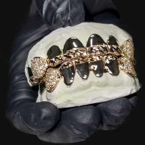 Grillz dentaire en or massif 18 carats, ensemble complet, pierres naturelles taille brillant rond, sertissage en canal, style hip-hop, unisexe, pour usage quotidien - Product Image 1