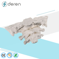 Modelo de Articulación Atlantoaxial Humana DRS1089, Modelo de Anatomía de Vértebras Cervicales para Entrenamiento