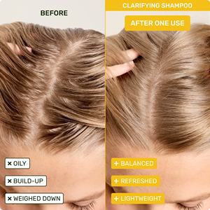 Champú Clarificante de Marca Privada OEM para Desintoxicación del Cabello y Cuidado del Cuero Cabelludo, Limpiador Capilar Purificante Profundo que Elimina Residuos, Grasa e Impurezas - Product Image 2