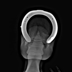 Rilevatore di raggi X a schermo piatto Wireless apparecchiature e accessori per radiologia umana veterinaria MSLFP06 - Product Image 5