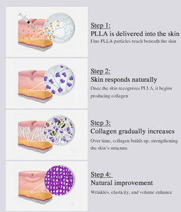 Premium Spherical PLLA Skin Rejuvenation Solution for Wrinkle Care and <b>Face</b> Lifting High Density Collagen Boosting Formula Vial - Product Image 5