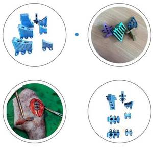 طقم سريع من أورتوبيتيكا لجراحة العظام البيطرية ثلاثي الأبعاد ، مسامير من سبائك التيتانيوم ، قفل قفص زرع TTA - Product Image 5