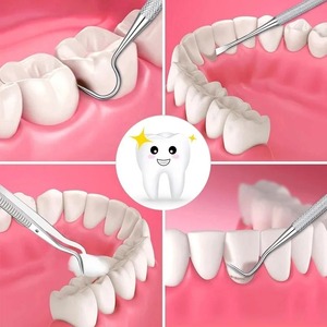 1Pcs Manual Stainless Steel <b>Teeth</b> <b>Cleaning</b> <b>Tool</b> Kit with Ergonomic Grip and 6 Jaw Positions Oral Care Set - Product Image 1