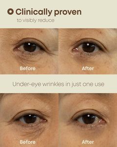 NINELESS Ever-Youth Crema de Ojos de Doble Efecto 20ml Crema Coreana para el Cuidado de la Piel - Product Image 4