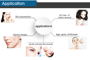 Adss ND-YAG Pico Laser loại bỏ hình xăm máy cho loại bỏ hình xăm mực, pigmention và sinh đánh dấu loại bỏ - Product Image 5