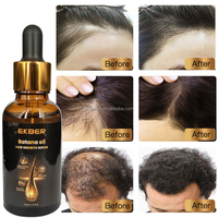 EKBER Etiqueta Privada Orgánica Natural Cuero Cabelludo Pérdida de Cabello Jengibre Biotina Aceite de Botana Aceite PARA EL Cabello 100 Puro Crecimiento de Cabello Crudo