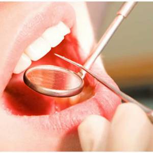กระจกตรวจฟันแบบมีด้ามจับลายกันลื่น สีเงิน เครื่องมือผ่าตัดคลาส 1 - Product Image 5