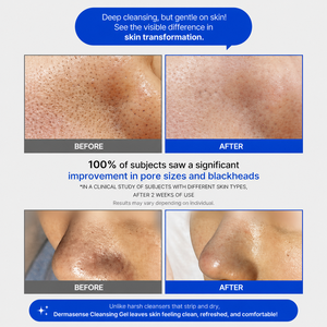AESTHEIN Derma Sense Gel Limpiador 300ml PREMIUM Limpiador Coreano con Esencia para Acné y Melasma, Tecnología Nano Patentada para Reparación de la Barrera Cutánea - Product Image 3
