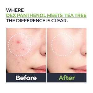 Ampoule K-Beauty Herbal Hydratation Quotidienne et Protection Nourrissante Anti-Poches Panthénol Arbre à Thé Soin Confort Cutané - Product Image 2