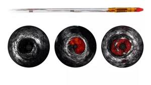 VOLCANO EAGLE EYE PLATINUM ST Juego de Instrumentos Manuales para Uso Hospitalario, Dispositivo Médico de Clase II con Certificación CE, Certificado ISO13485 - Product Image 2