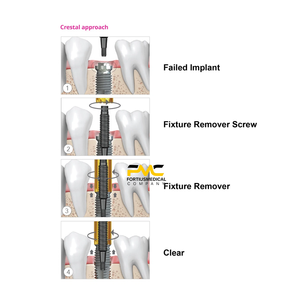 Kit de retrait d'implants dentaires avec tournevis hexagonal et clé Neobiotech FR pour des procédures efficaces de retrait de vis - Product Image 2