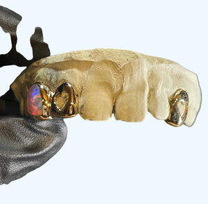 Grillz dentaire en or massif 24K avec incrustation de cœur en opale sertie clos, style hip-hop pour homme, bijou corporel pour usage quotidien - Product Image 1
