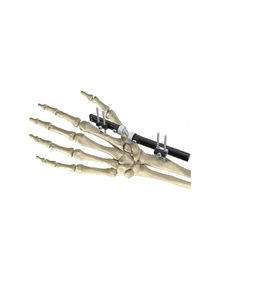 New Arrival Hot Sale 2025 Customized Premium Quality Professional Medical External Fixator System 5mm - Product Image 6